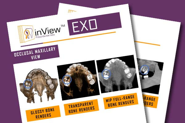 Inview Exo